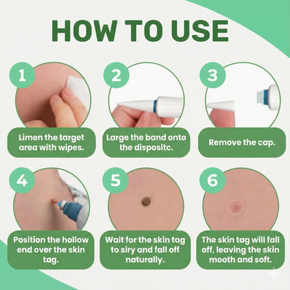 ClearTag Removal Kit™