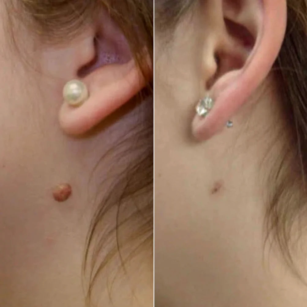 ClearTag Removal Kit™