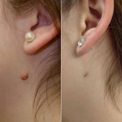 ClearTag Removal Kit™